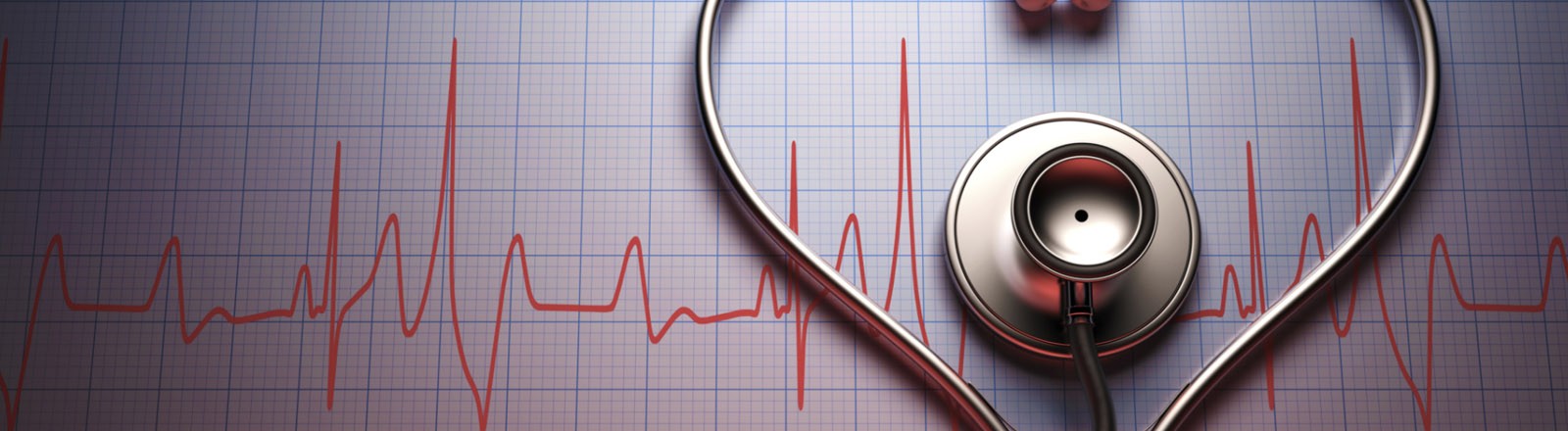 La Rehabilitación Cardiovascular en la Cardiopatía Isquémica… un tratamiento subutilizado?