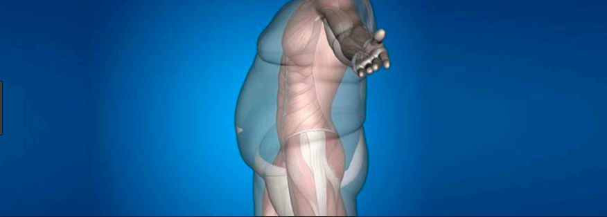 Ayudando a padecer sarcopenia (parte II)