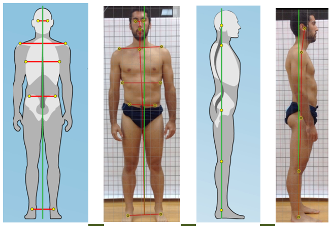 La Evaluación Postural Estática (EPE): propuesta de valoración.