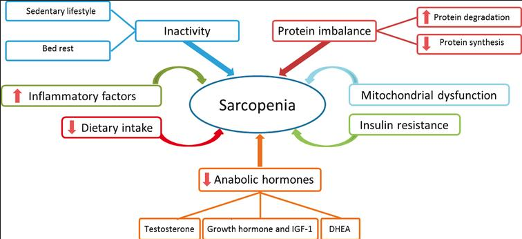 Sindrome de desnutrición-sarcopenia