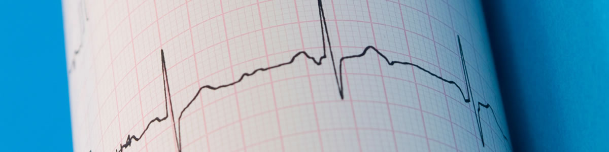 Electrocardiografía: Interpretación de Arritmias Asociadas a Bradicardia