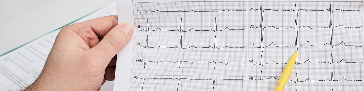 Electrocardiografía: Interpretación de Arritmias Asociadas a Taquiarritmias Electrocardiografía: Interpretación de Arritmias Asociadas a Taquiarritmias
