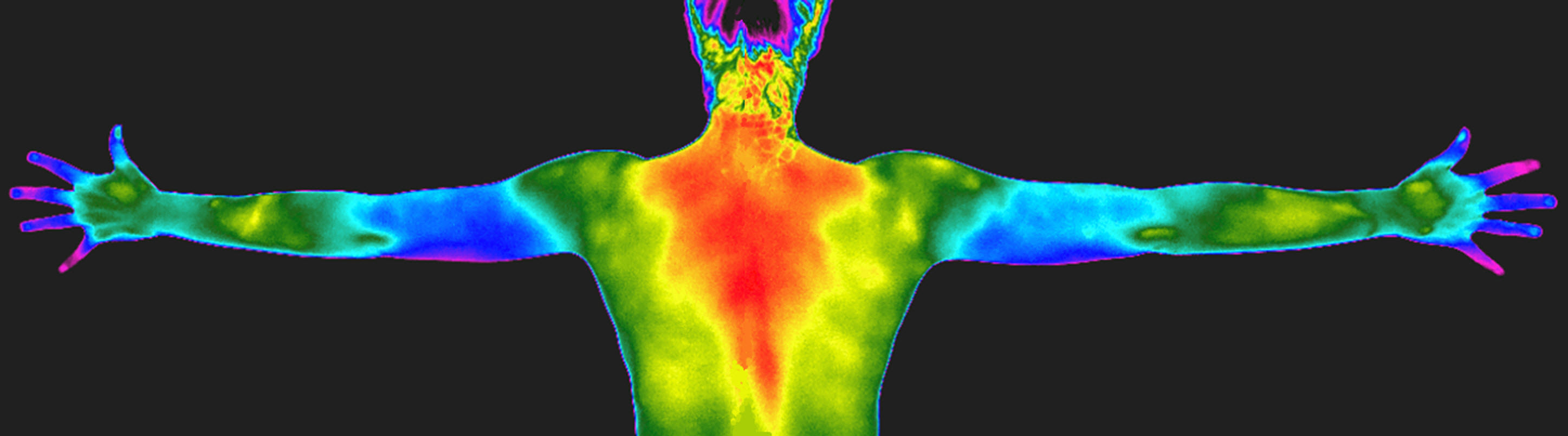 Termografía Clínica Aplicada a Medicina de Precisión Termografía Clínica Aplicada a Medicina de Precisión